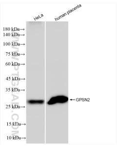 GPSN2 Recombinant monoclonal antibody proteintech 83592-4-RR