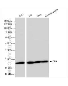 CD9 Recombinant monoclonal antibody proteintech 84142-1-RR