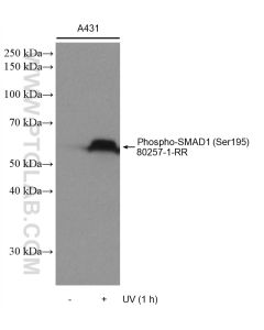 Phospho-SMAD1 (Ser195) Recombinant monoclonal antibody proteintech 80257-1-RR