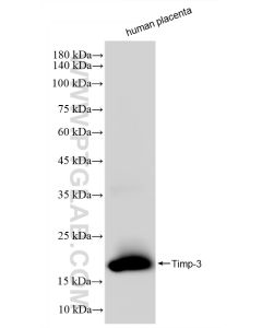Timp-3 Recombinant monoclonal antibody proteintech 83627-1-RR