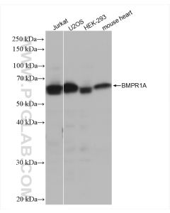BMPR1A Recombinant monoclonal antibody proteintech 82928-1-RR