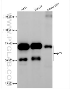 TP63 Recombinant monoclonal antibody proteintech 86154-1-RR