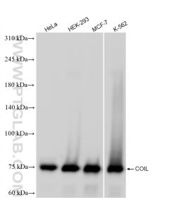 Coilin Recombinant monoclonal antibody proteintech 87171-1-RR