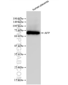 AFP Recombinant monoclonal antibody proteintech 82982-6-RR