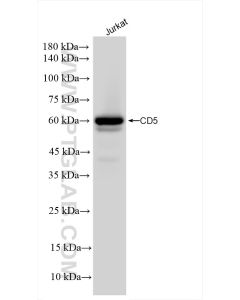 CD5 Recombinant monoclonal antibody proteintech 83543-7-RR