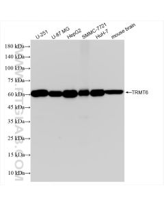 TRMT6 Recombinant monoclonal antibody proteintech 83843-6-RR