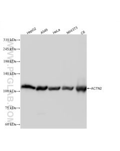 ACTN2 Recombinant monoclonal antibody proteintech 85857-4-RR
