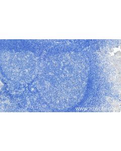 Anti-Human TNFRSF9/CD137 Rabbit Recombinant Antibody Proteintech  98112-1-RR
