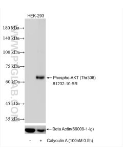 Phospho-AKT (Thr308) Recombinant monoclonal antibody Proteintech  81232-10-RR