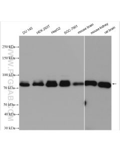 FOXO1 Polyclonal antibody Proteintech  18592-1-AP