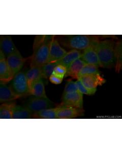 Anti-Human Survivin Rabbit Recombinant Antibody Proteintech  98624-1-RR