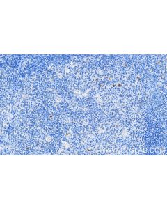 Anti-Human CTLA-4/CD152 Rabbit Recombinant Antibody Proteintech  98078-1-RR