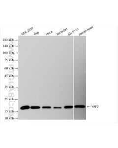 YAF2 Recombinant monoclonal antibody Proteintech  83798-6-RR