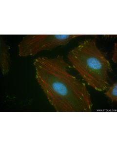 Anti-Human uPAR/CD87 Rabbit Recombinant Antibody Proteintech  98048-1-RR