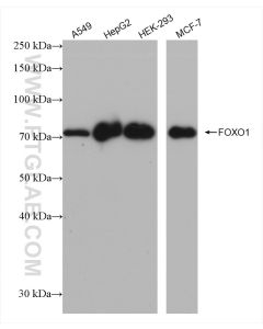 FOXO1 Recombinant monoclonal antibody Proteintech  82997-1-RR