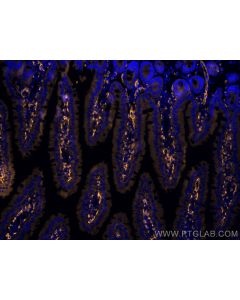 Anti-Mouse PLVAP (MECA-32) Proteintech  65214-1-Ig
