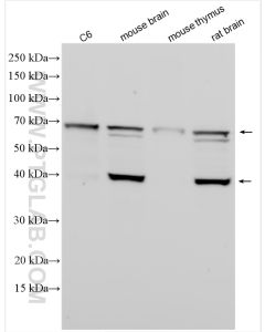 Septin 9 Polyclonal antibody Proteintech  10769-1-AP