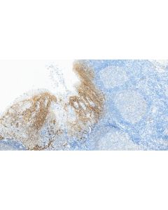 Anti-Human CD138/Syndecan-1 Rabbit Recombinant Antibody Proteintech  98051-1-RR