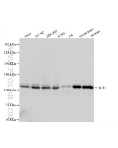 MIB1 Recombinant monoclonal antibody Proteintech  83718-5-RR