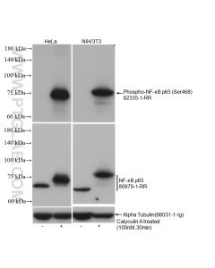 Phospho-NF-κB p65 (Ser468) Recombinant monoclonal antibody Proteintech  82335-1-RR