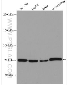 Osteopontin Polyclonal antibody Proteintech  22952-1-AP
