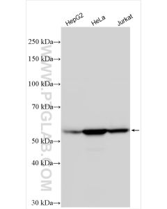 Vimentin Polyclonal antibody Proteintech  10366-1-AP