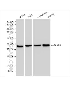 TADA1L Recombinant monoclonal antibody Proteintech  83641-4-RR