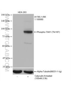 Phospho-TAK1 (Thr187) Recombinant monoclonal antibody Proteintech  81785-1-RR