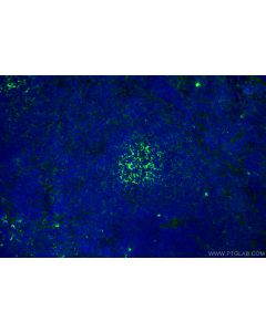 Anti-Mouse CD19 (1D3) Proteintech  65290-1-Ig