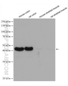 Alpha smooth muscle actin specific Recombinant monoclonal antibody Proteintech  80008-1-RR