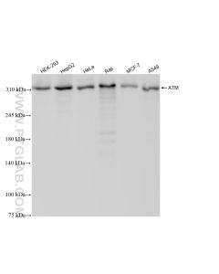 ATM Recombinant monoclonal antibody Proteintech  83608-5-RR