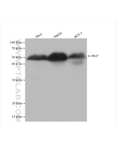 RILP Recombinant monoclonal antibody Proteintech  82996-4-RR