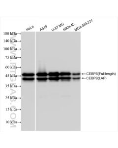CEBPB Recombinant monoclonal antibody Proteintech  83791-6-RR