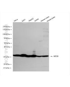 MED6 Recombinant monoclonal antibody Proteintech  84184-4-RR