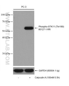 Phospho-STK11/LKB1 (Thr189) Recombinant monoclonal antibody Proteintech  80127-1-RR