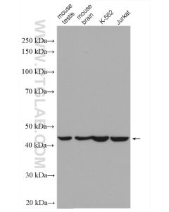 Septin 2 Polyclonal antibody Proteintech  11397-1-AP