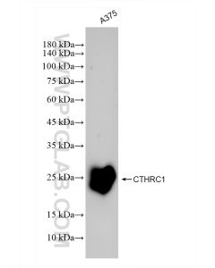 CTHRC1 Recombinant monoclonal antibody Proteintech  83629-1-RR