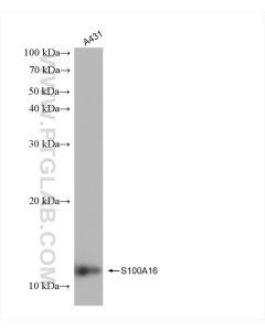 S100A16 Recombinant monoclonal antibody Proteintech  82923-1-RR