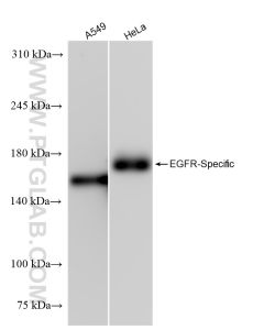 EGFR Recombinant monoclonal antibody Proteintech  83806-1-RR