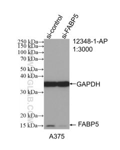 FABP5 Polyclonal antibody Proteintech  12348-1-AP