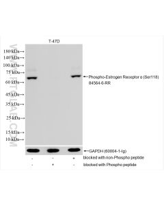 Phospho-Estrogen Receptor α (Ser118) Recombinant monoclonal antibody Proteintech  84564-6-RR