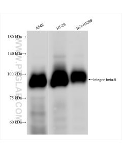 Integrin beta 5 Recombinant monoclonal antibody Proteintech  83514-3-RR