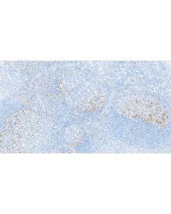 Anti-Human PD-1/CD279 Rabbit Recombinant Antibody Proteintech  98068-1-RR