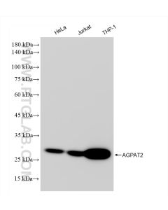 AGPAT2 Recombinant monoclonal antibody Proteintech  83349-3-RR