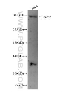 FAM38B Recombinant monoclonal antibody Proteintech  83488-4-RR