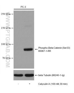 Phospho-Beta Catenin (Ser33) Recombinant monoclonal antibody Proteintech  80067-1-RR