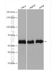 P62/SQSTM1 Polyclonal antibody Proteintech  18420-1-AP