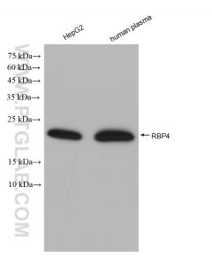 RBP4 Recombinant monoclonal antibody Proteintech  82934-1-RR