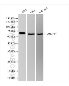 Angiopoietin 1 Recombinant monoclonal antibody Proteintech  81990-4-RR