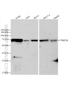 TRMT2A Recombinant monoclonal antibody Proteintech  83463-8-RR